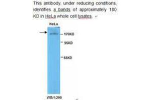 Image no. 1 for anti-Topoisomerase (DNA) II beta 180kDa (TOP2B) antibody (ABIN790819) (TOP2B antibody)