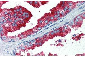 Immunohistochemistry with Human Prostate lysate tissue at an antibody concentration of 5.