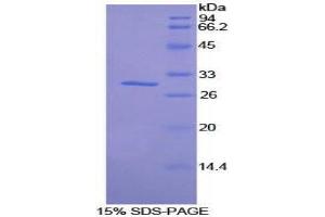 SDS-PAGE (SDS) image for Salt-Inducible Kinase 2 (SIK2) (AA 674-916) protein (His tag) (ABIN2126705)