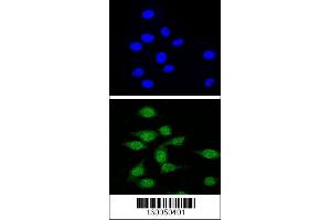 Confocal immunofluorescent analysis of AIRE Antibody with 293 cell followed by Alexa Fluor 488-conjugated goat anti-rabbit lgG (green). (AIRE antibody  (AA 64-92))
