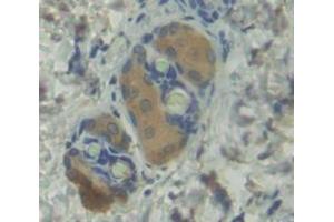 Figure. (BMP1 antibody  (AA 856-982))