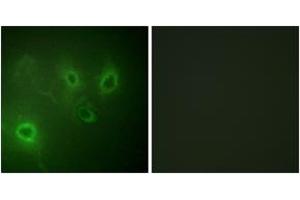 Immunofluorescence analysis of COS7 cells, using InsP3R1 (Ab-1598/1588) Antibody. (ITPR1 antibody  (AA 1566-1615))