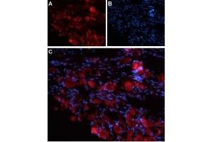 Expression of TRPV4 in rat DRG - Immunohistochemical staining of rat dorsal root ganglion (DRG) frozen sections using Anti-TRPV4 (extracellular) Antibody (ABIN7043852, ABIN7044071 and ABIN7044072). (TRPV4 antibody  (3rd Extracellular Loop))