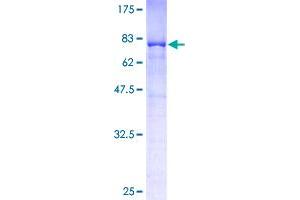 EIF3D Protein (AA 1-548) (GST tag)