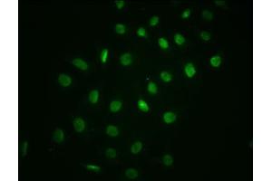 Immunofluorescence (IF) image for anti-Nuclear Factor of kappa Light Polypeptide Gene Enhancer in B-Cells Inhibitor, alpha (NFKBIA) (pSer32) antibody (ABIN7127721)