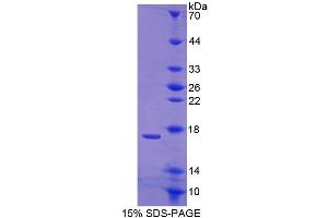 SDS-PAGE (SDS) image for Calcium Binding Protein 1 (CABP1) (AA 238-370) protein (His tag) (ABIN6239538) (CABP1 Protein (AA 238-370) (His tag))