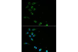 Immunofluorescence analysis of MCF-7 cells using HFE antibody.