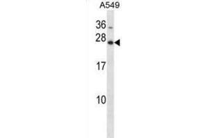 Western Blotting (WB) image for anti-Homeobox B7 (HOXB7) antibody (ABIN2998352) (HOXB7 antibody)