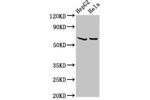 Western Blot Positive WB detected in: HepG2 whole cell lysate, Hela whole cell lysate All lanes: MT-ND5 antibody at 4. (MT-ND5 antibody  (AA 503-581))
