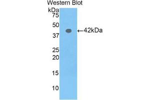 Western blot analysis of the recombinant protein. (Profilin 3 antibody  (AA 1-132))