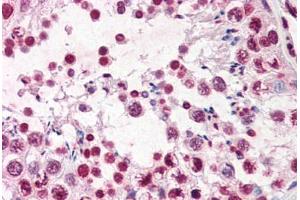 Human Testis (formalin-fixed, paraffin-embedded) stained with ERCC3 antibody ABIN351537 at 5-10 ug/ml followed by biotinylated anti-mouse IgG secondary antibody ABIN481714, alkaline phosphatase-streptavidin and chromogen. (ERCC3 antibody  (AA 242-261))