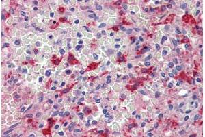 Spleen, Human: Formalin-Fixed, Paraffin-Embedded (FFPE) (HMOX1 antibody)