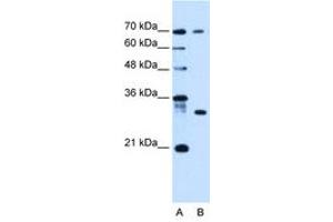 Image no. 1 for anti-ATPase, H+ Transporting, Lysosomal Accessory Protein 1-Like (ATP6AP1L) (C-Term) antibody (ABIN6736678)