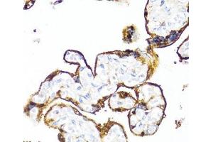 Immunohistochemistry of paraffin-embedded Human placenta using HSD17B1 Polyclonal Antibody at dilution of 1:100 (40x lens). (HSD17B1 antibody)