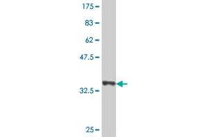 Western Blot detection against Immunogen (37. (ACMSD antibody  (AA 179-278))