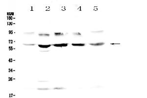 Western blot analysis of Steroid sulfatase using anti-Steroid sulfatase antibody . (STS antibody  (AA 297-396))