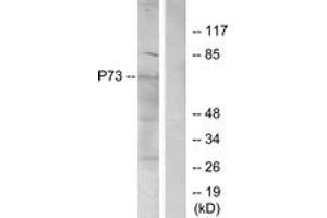 Western blot analysis of extracts from K562 cells, using p73 (Ab-99) Antibody. (Tumor Protein p73 antibody  (AA 66-115))