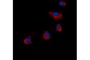 Immunofluorescent analysis of ARRDC4 staining in COLO205 cells. (ARRDC4 antibody  (Center))