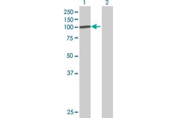 DDX20 antibody  (AA 1-824)