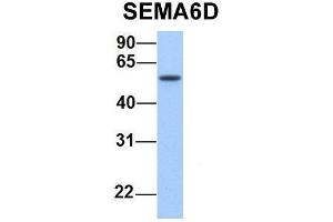 Host:  Rabbit  Target Name:  SEMA6D  Sample Type:  Human Fetal Lung  Antibody Dilution:  1. (SEMA6D antibody  (N-Term))