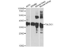 Western blot analysis of extracts of various cell lines, using TALDO1 antibody. (TALDO1 antibody  (AA 1-337))