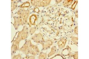 Immunohistochemistry of paraffin-embedded human kidney tissue using ABIN7145574 at dilution of 1:100 (MTHFD2 antibody  (AA 40-250))
