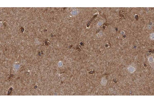 TRPM2 antibody  (C-Term)