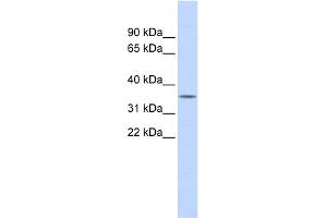 WB Suggested Anti-FCN1 Antibody Titration: 0. (FCN1 antibody  (Middle Region))