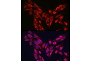 Immunofluorescence analysis of U-2 OS cells using PINK1 Rabbit pAb (ABIN6128457, ABIN6145665, ABIN6145667 and ABIN6215214) at dilution of 1:250 (40x lens). (PINK1 antibody  (AA 282-581))
