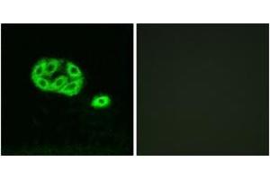 Immunofluorescence analysis of NIH-3T3 cells, using PI3-kinase p85-alpha/gamma (Phospho-Tyr467/199) Antibody. (PI3K p85 alpha/gamma antibody  (pTyr467))
