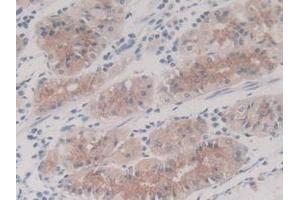 IHC-P analysis of Human Stomach Tissue, with DAB staining. (IL-8 antibody  (AA 23-101))