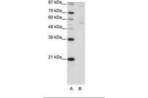 Image no. 1 for anti-Zinc Finger Protein 92 (ZNF92) (C-Term) antibody (ABIN203189) (ZNF92 antibody  (C-Term))