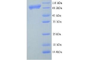SDS-PAGE (SDS) image for Coagulation Factor VIII (F8) (AA 15-629) protein (His tag) (ABIN4976686) (Factor VIII Protein (AA 15-629) (His tag))