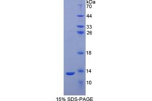 SDS-PAGE analysis of Human S100A2 Protein.