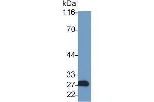 Detection of GZMA in Rat Kidney lysate using Polyclonal Antibody to Granzyme A (GZMA) (GZMA antibody  (AA 29-260))