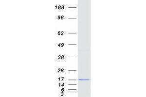 Western Blotting (WB) image for Ubiquitin-Conjugating Enzyme E2W (UBE2W) (Transcript Variant 2) protein (Myc-DYKDDDDK Tag) (ABIN2734877)