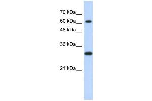 WB Suggested Anti-ERF Antibody Titration:  0. (ERF antibody  (Middle Region))