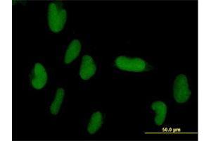 Immunofluorescence of purified MaxPab antibody to ZNF193 on HepG2 cell. (Zinc Finger and SCAN Domain Containing 9 (ZSCAN9) (AA 1-394) antibody)
