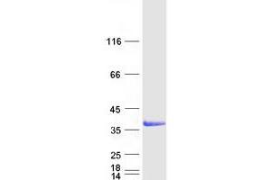 Validation with Western Blot (Galectin 9 Protein (Transcript Variant 2) (Myc-DYKDDDDK Tag))