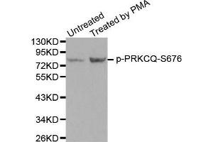 Western blot analysis of extracts from PC12 cells using Phospho-PRKCQ-S676 antibody. (PKC theta antibody  (pSer676))
