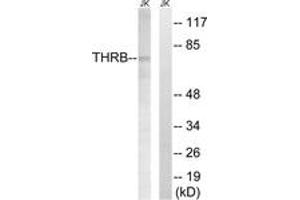 Western blot analysis of extracts from Jurkat cells, treated with etoposide 25uM 24H, using THRB (AP2,Cleaved-Arg327) Antibody. (THRB antibody  (Cleaved-Arg327))