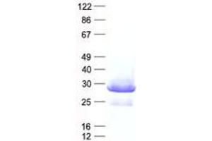 Validation with Western Blot (QTRT1 Protein (His tag))