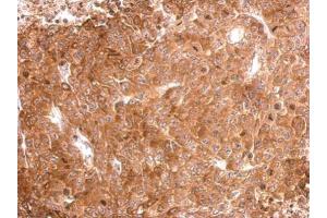 IHC-P Image Tau antibody detects MAPT protein at cytosol on D54MG xenograft by immunohistochemical analysis. (MAPT antibody)