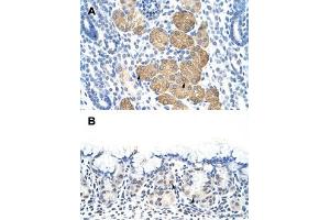 Immunohistochemical staining (Formalin-fixed paraffin-embedded sections) of human kidney (A) and human stomach (B) with DAZ4 polyclonal antibody  at 4-8 ug/mL working concentration. (DAZ4 antibody  (N-Term))