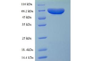 SDS-PAGE (SDS) image for Electron-Transferring-Flavoprotein Dehydrogenase (ETFDH) (AA 34-617) protein (His tag) (ABIN5714330)