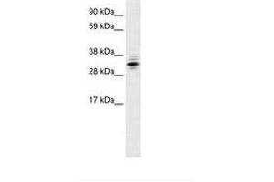 Image no. 2 for anti-Zinc Finger Protein 654 (ZNF654) (AA 289-338) antibody (ABIN6735934)