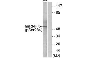 Western blot analysis of extracts from 3T3 cells, treated with EGF (200ng/ml, 30mins), using hnRNP K (Phospho-Ser284) antibody.