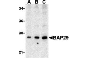 Western Blotting (WB) image for anti-B-Cell Receptor-Associated Protein 29 (BCAP29) (Middle Region) antibody (ABIN1030880) (BCAP29 antibody  (Middle Region))
