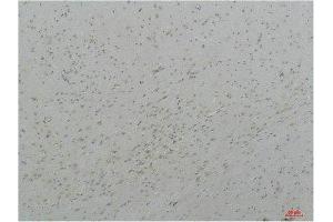 CACNA1I antibody