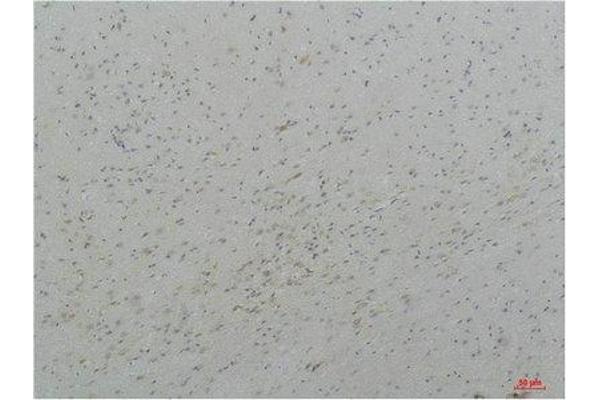 CACNA1I antibody